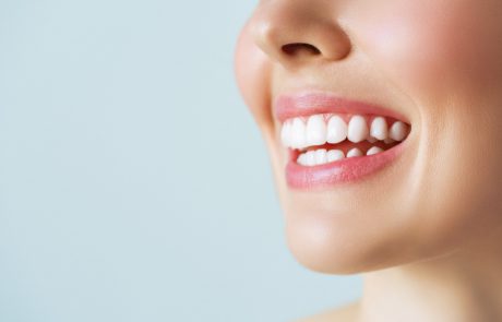 התחנות השונות בתהליך הלבנת השיניים